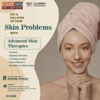 Clearskin and Haircare Clinic in Kurnool || Hair Clinic || Laser Treatment || Skin Care  || Painfree