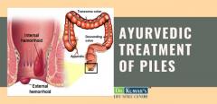 Best Ayurvedic Treatment for piles in Delhi | faridabad