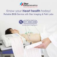 ECG Test at Home Near Me? Trust Star Home Care